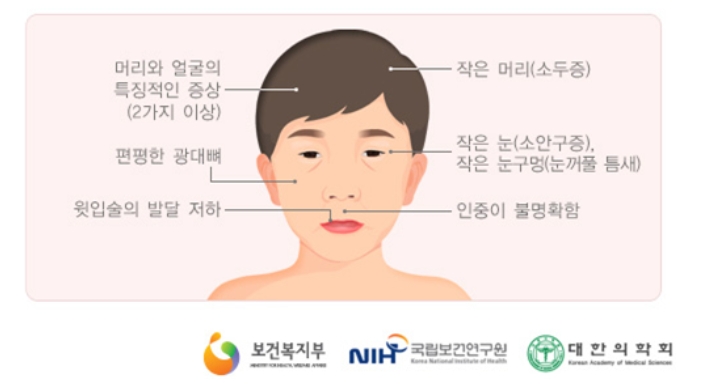 임산부가 먹으면 안되는 음식_태아 알코올 증후군